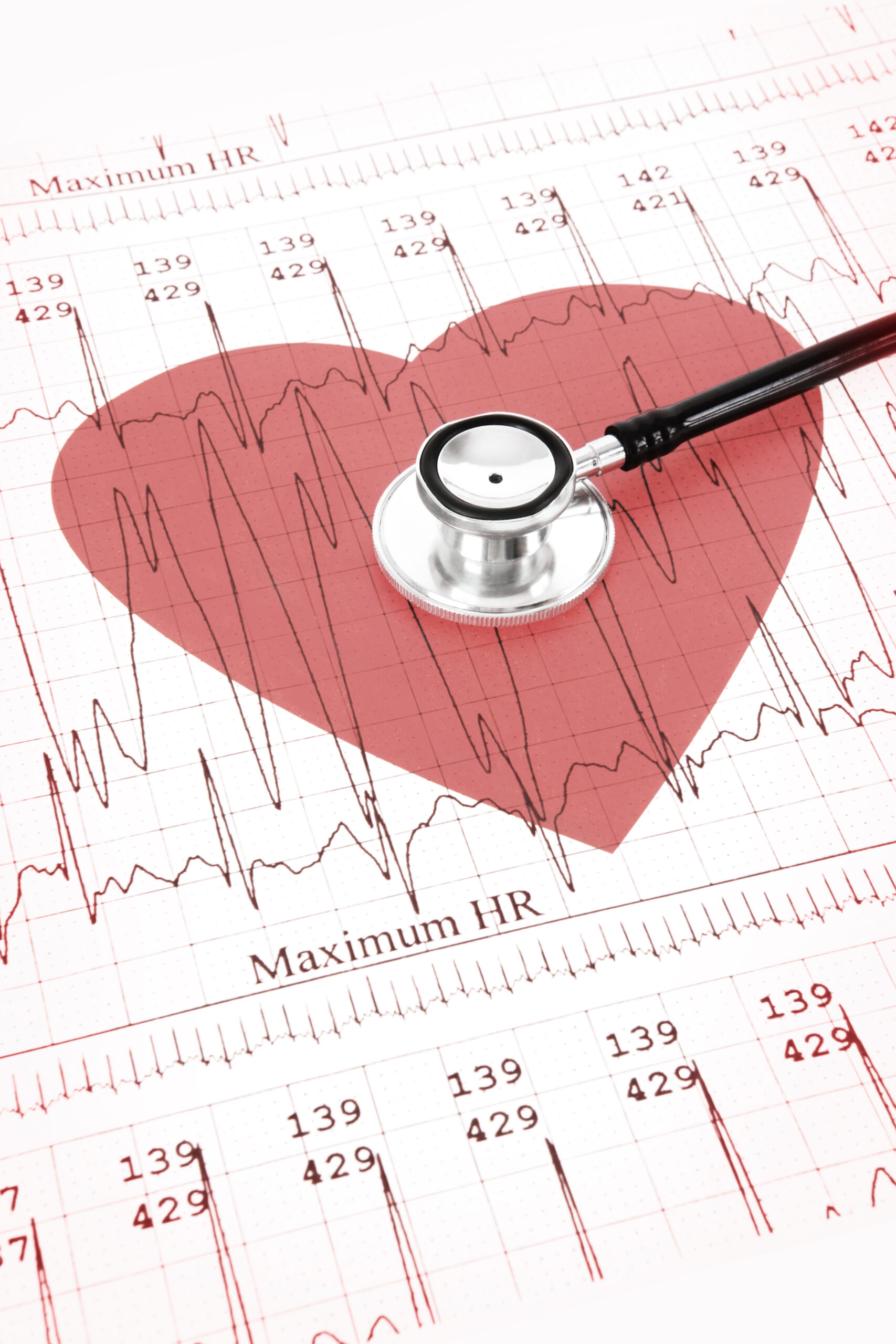 Heart Rate Variability (HRV) monitoring at Savant Wellness in San Francisco